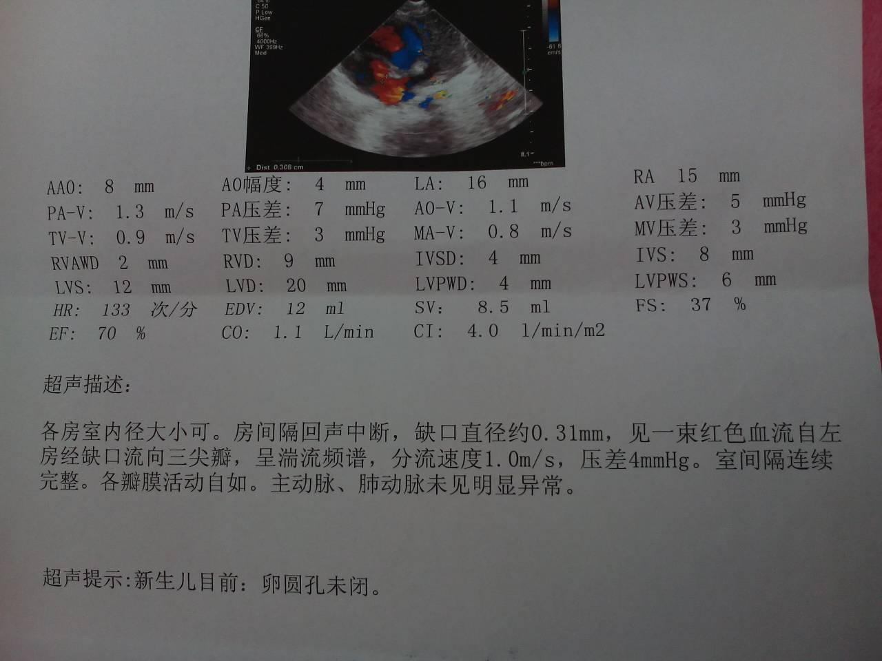 问答 问答首页  为您推荐: 其他回答 先天性心脏病是儿童时期最常见的