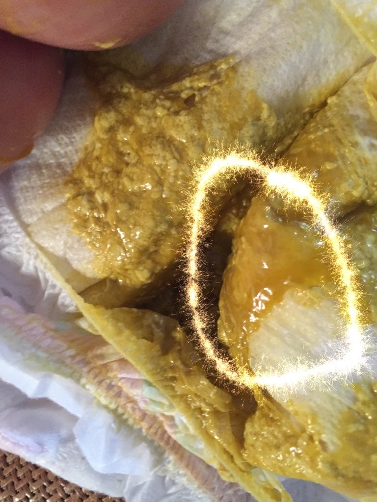 宝妈们,宝宝这样正常吗?画圈处有些像鼻涕一样的东西正常吗?