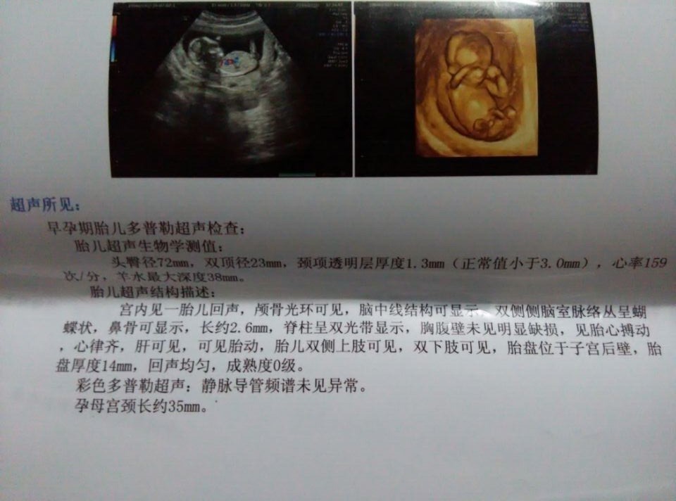 男是女,宝宝在盘腿坐着很可爱,只能15周以后通过b超动态观察胎儿性别