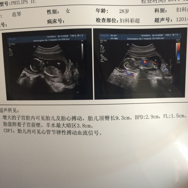 胎儿14周有多大图片
