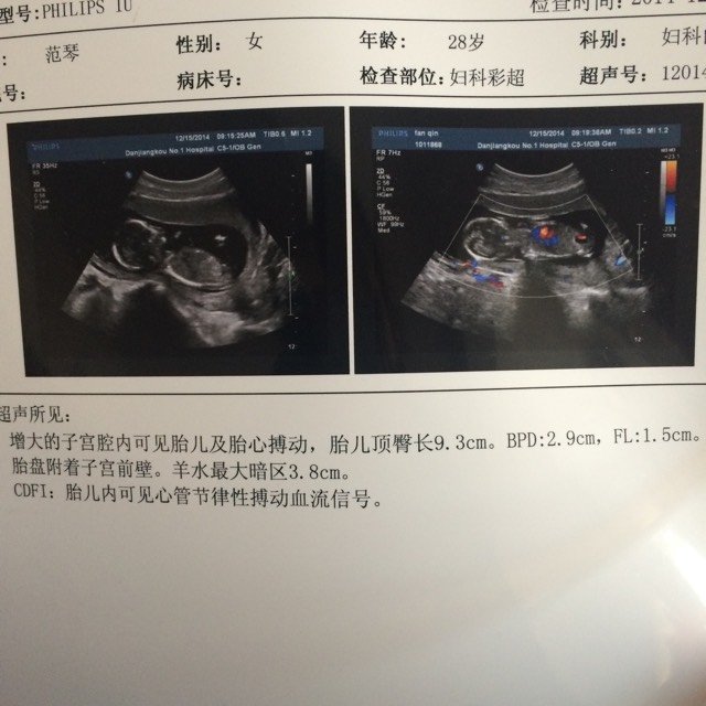 我算的13周,醫生非說14周加,9月1號末次月經,6號結束,10號同房