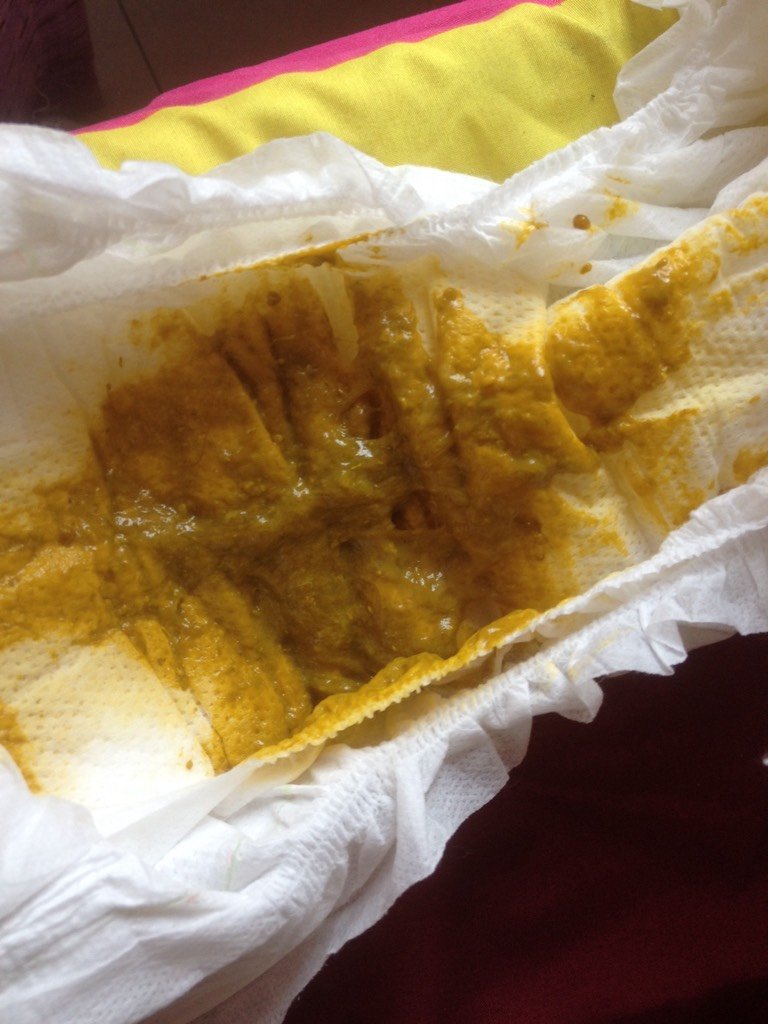 有图慎入六个月宝宝添加米粉后的粑粑,正常吗?黏液多是为什么?
