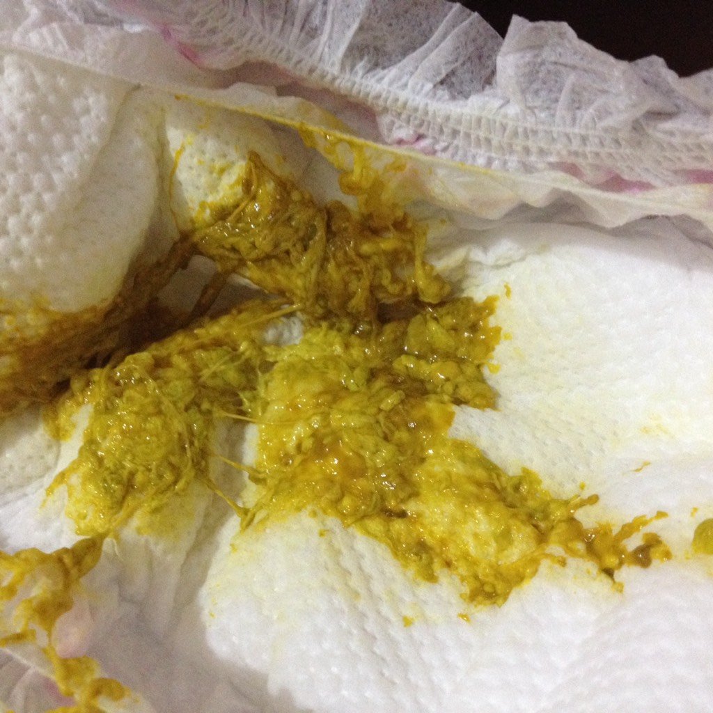 还有我家宝宝不爱喝白开水 我家宝宝最近粑粑是绿色带点粘稠下面如图