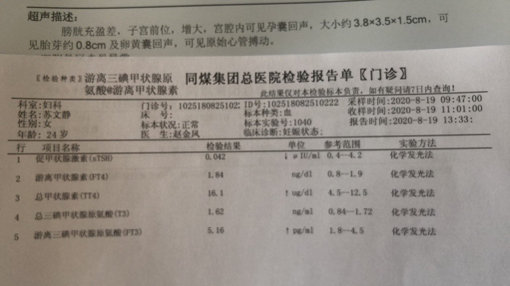 总甲状腺素tt4偏高,游离三碘甲状腺原氨酸偏高