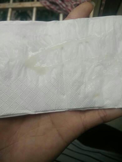 易孕期这么多白白带正常吗?