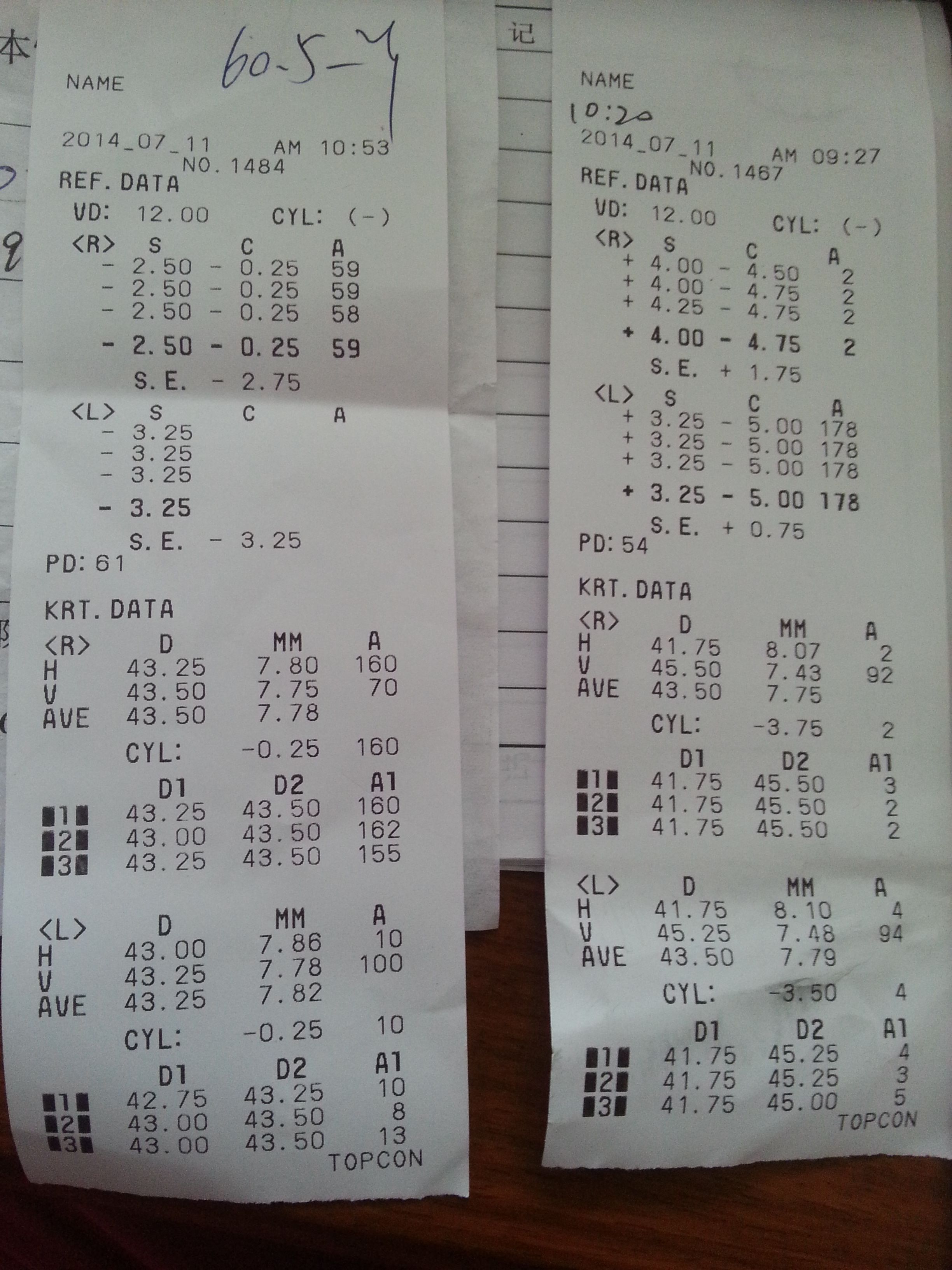 这两张验光单怎么看?谢谢了左边是我的,右边是一个8岁小孩的