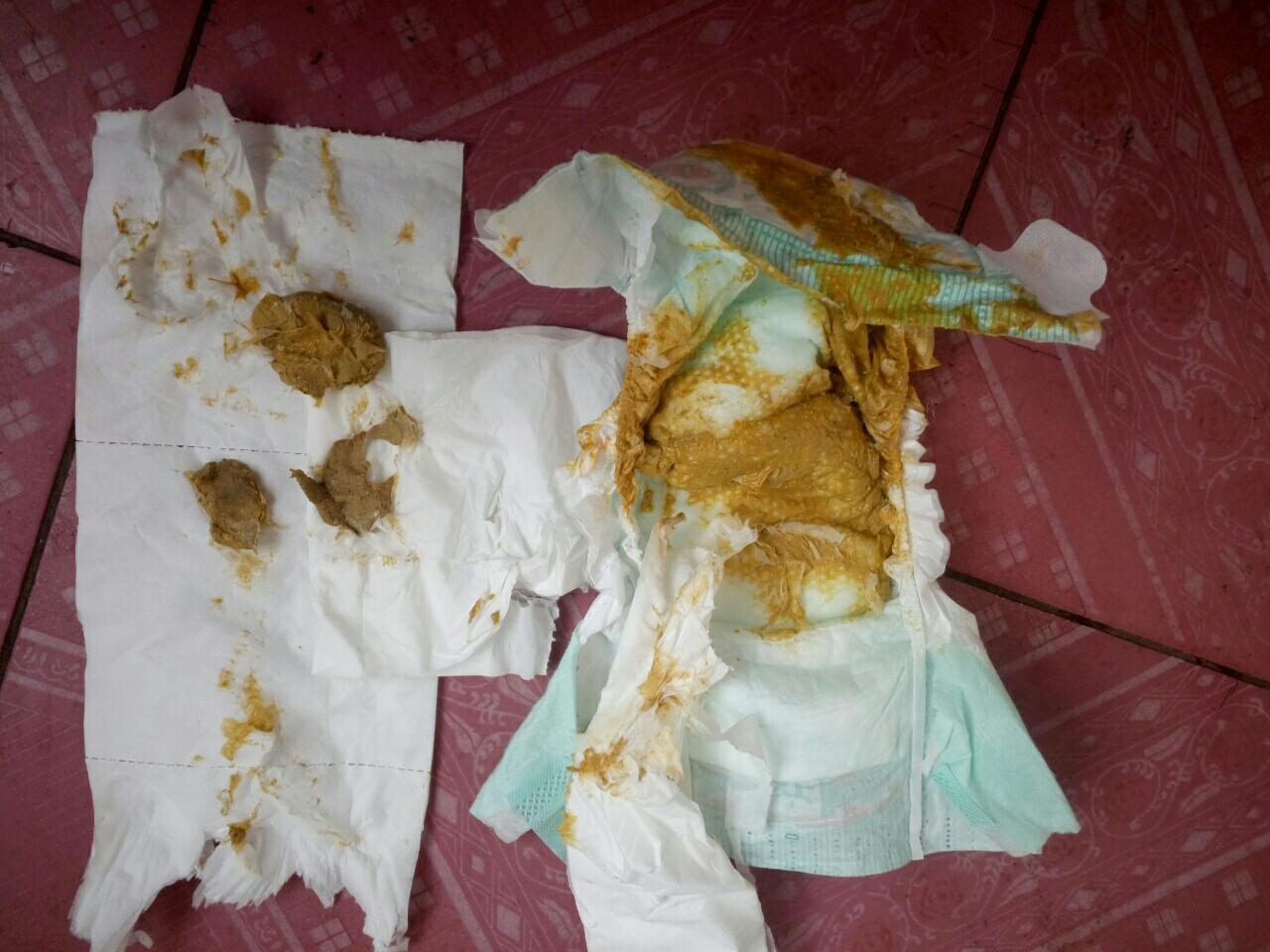 6楼 宝宝从昨天早上九点拉一大包水,直到今天下午四点又拉这种的是