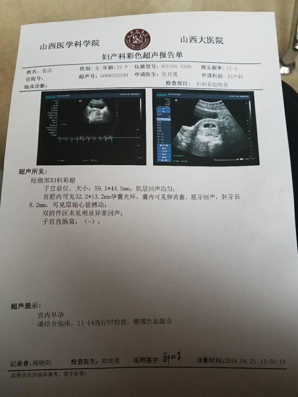 怀孕7周彩超图片