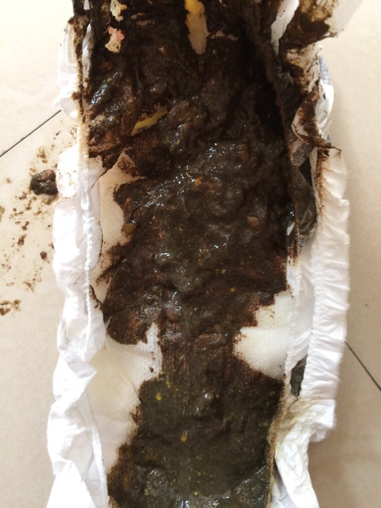 宝宝拉肚子拉好几天啦 有时候是拉黑黑的这是怎么回事 药也给吃过 丁