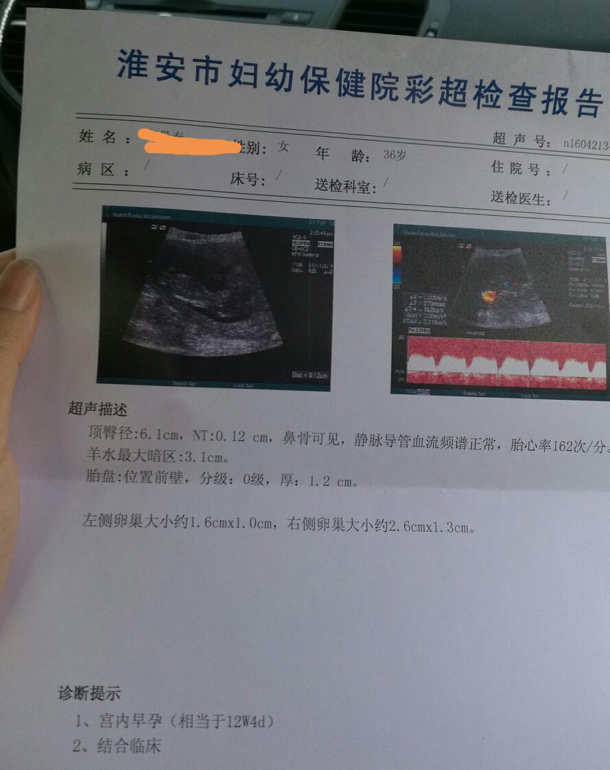 今天做了nt檢查,順利通過 原來不需要空腹也不用憋尿