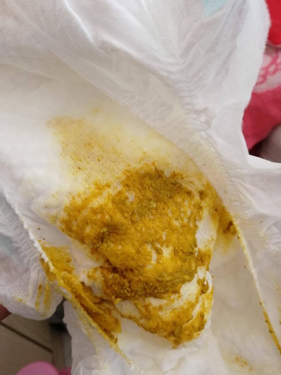 22天的宝宝大便有奶瓣