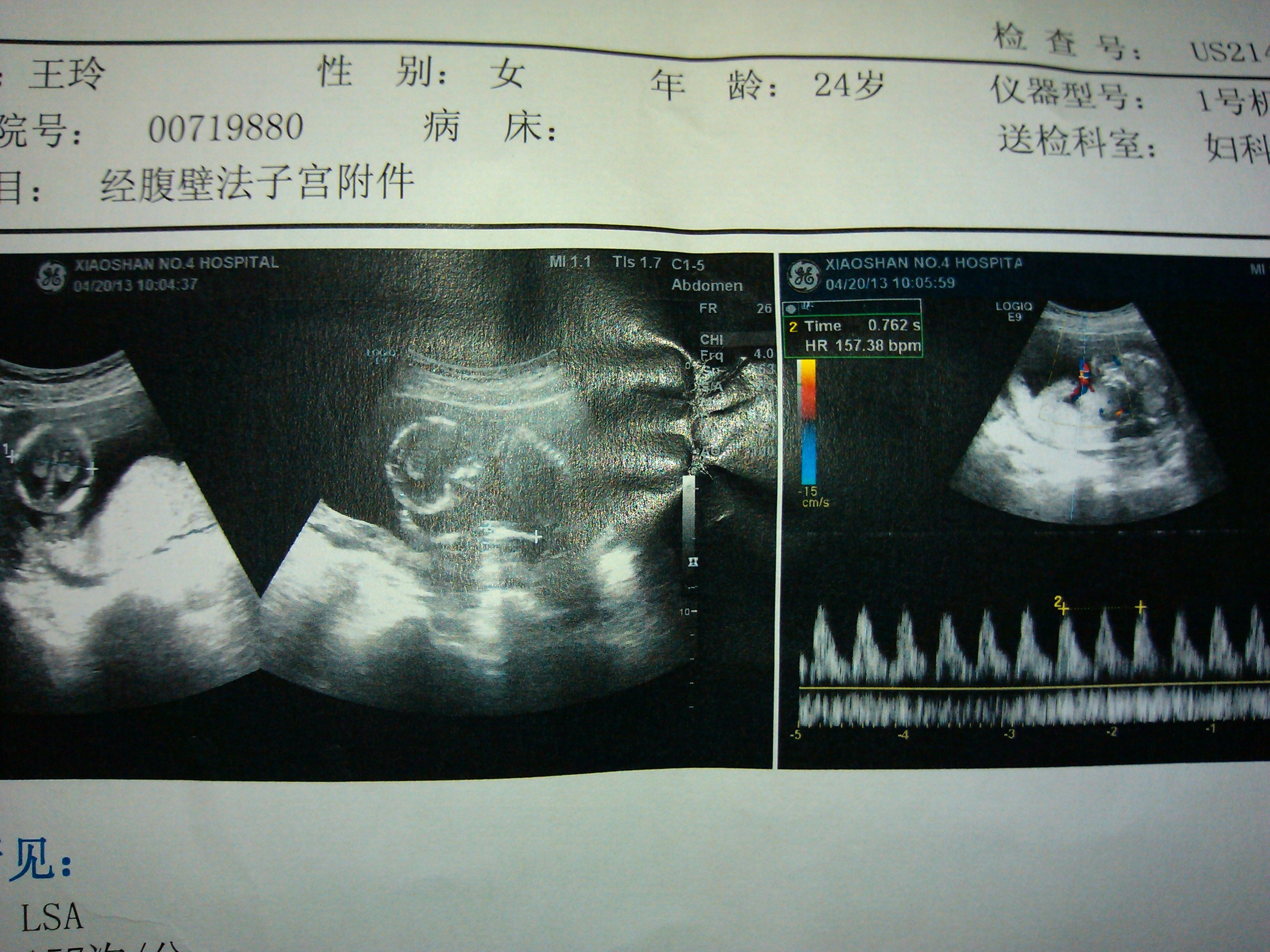怀孕1-10月胎儿生长发育图 ，赶紧收了！-搜狐