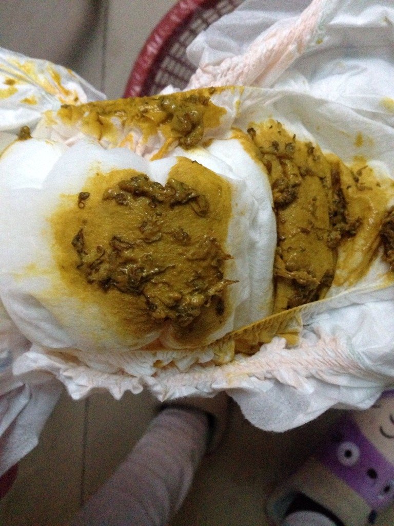 宝贝3天没拉便便,今天早上拉了!