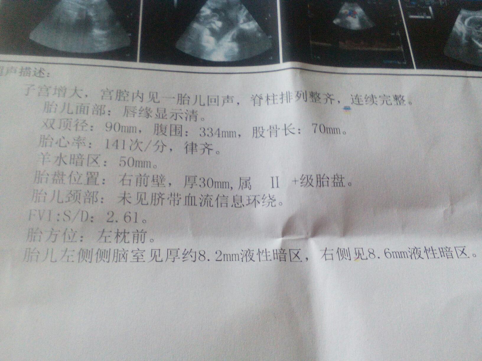 33周+是不是有点大了