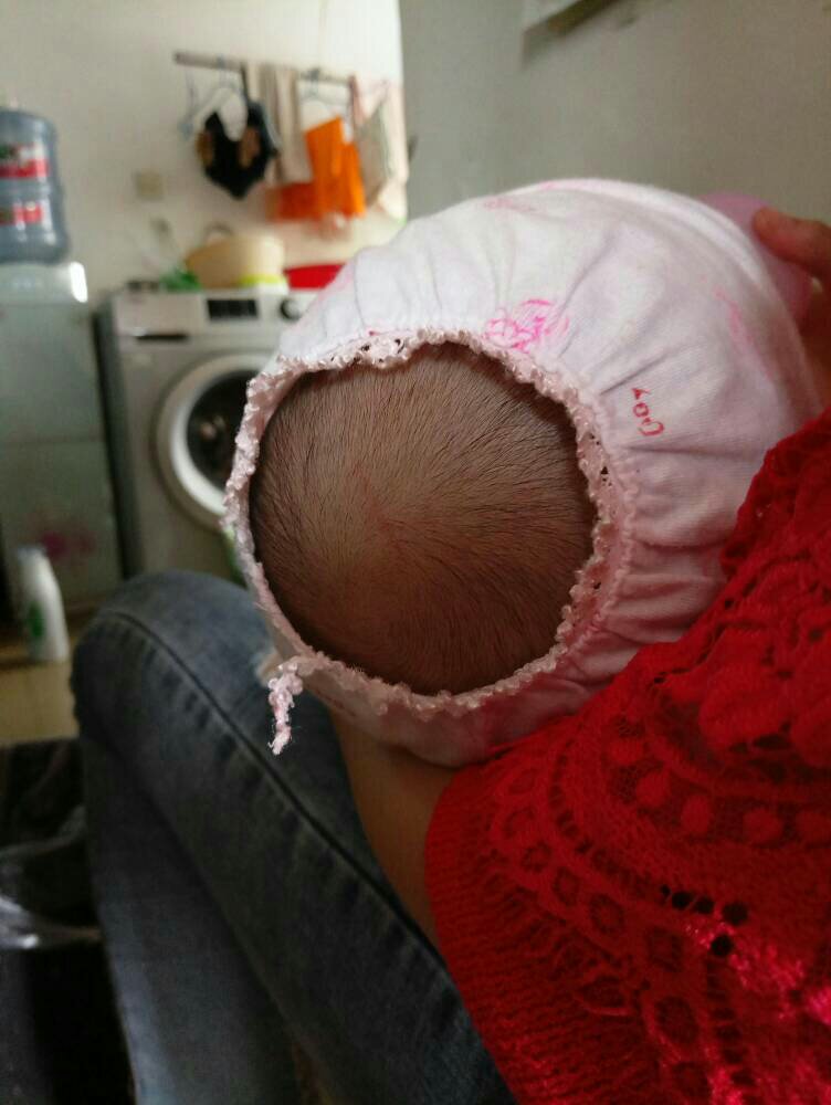 两个月大宝宝头顶突然出现了一道红色痕迹,这怎么回事啊?