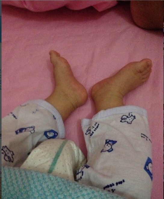 三个月的宝宝,总是曲着腿,有点担心是不是外八o型腿,我跟我老婆都没有