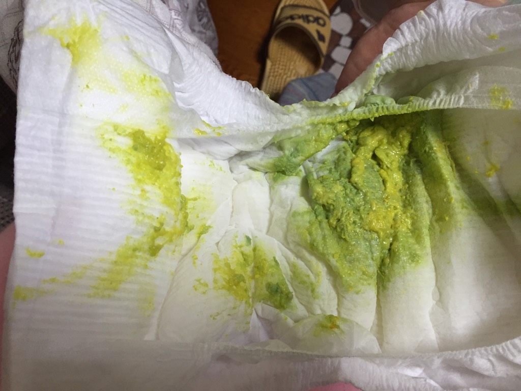 吃头孢泊肟酯干混悬剂宝宝会拉绿色的大便吗?