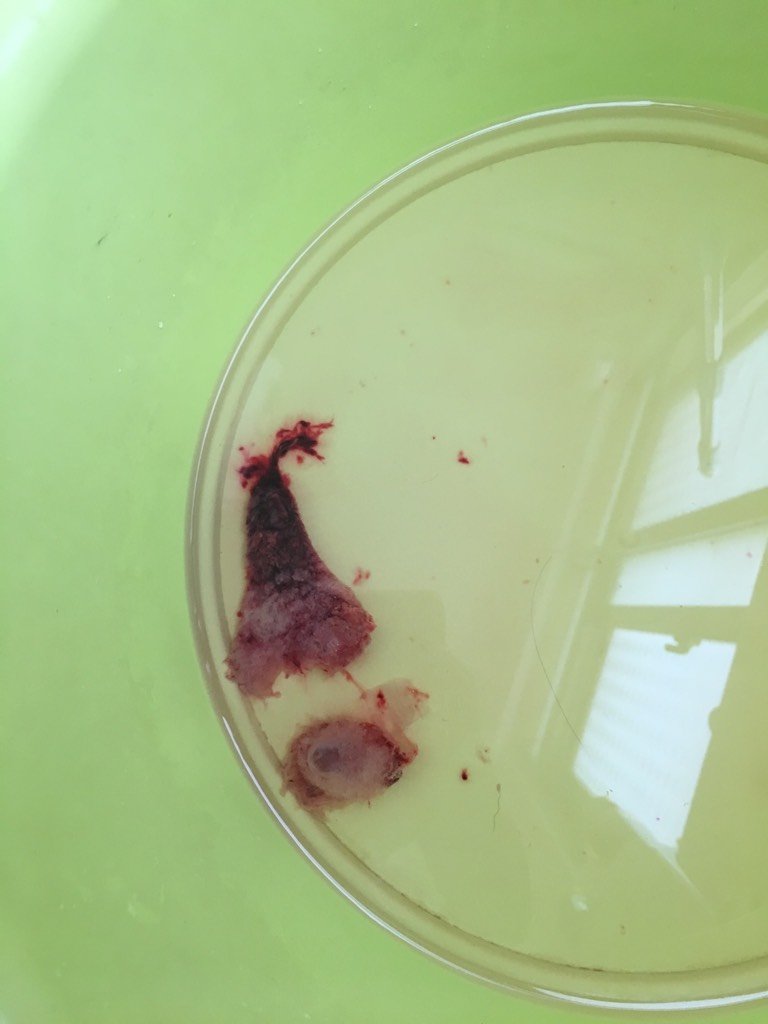 求问这个是胚胎吗？因为胎停所以今天早上吃药药流了，现在掉出两坨肉