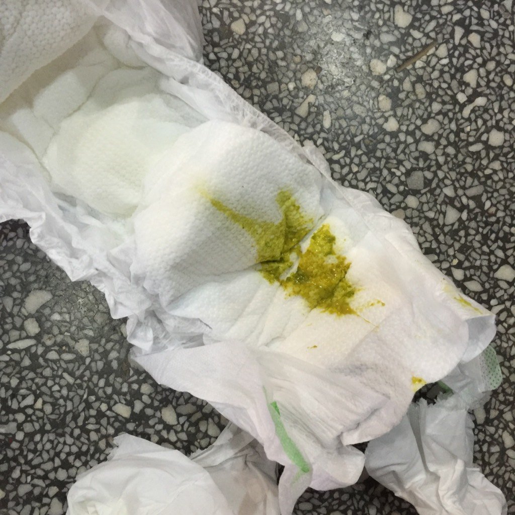 快四个月的宝宝拉绿屎拉三天乐还拉肚子拉出来的屎像黏液怎么回事用