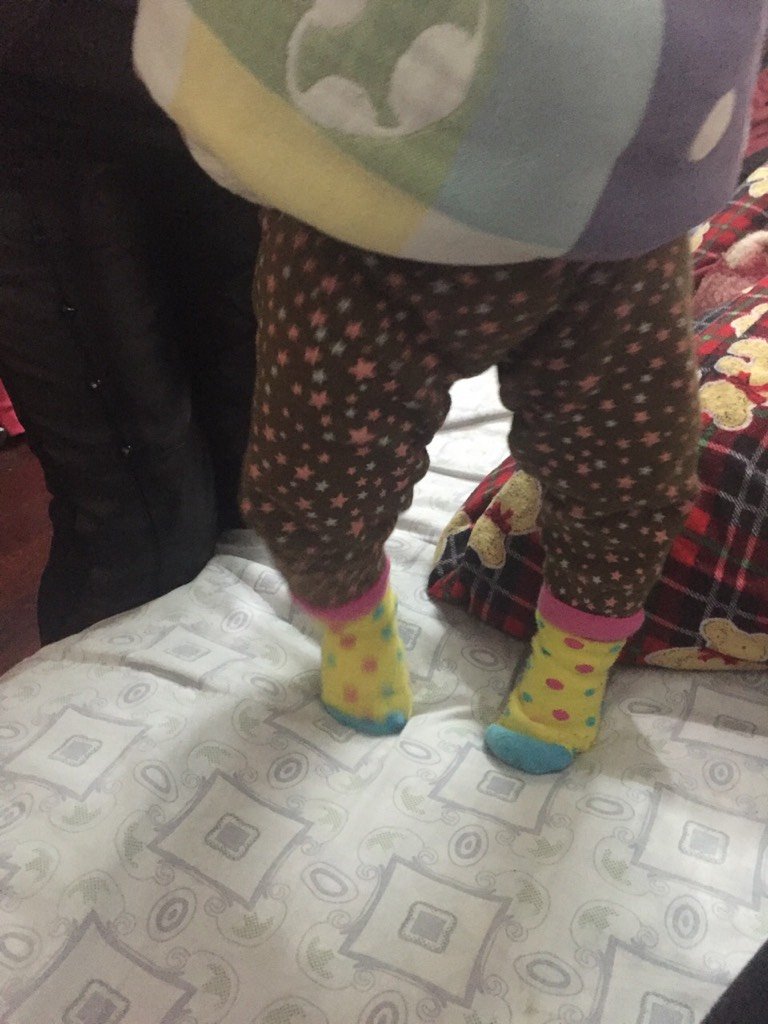 宝宝11个月,走路的时候感觉腿打不直,这种情况正常吗?