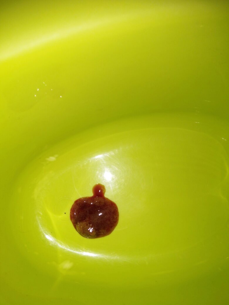 之前有拉肚子,不是水状,是有点粘稠状的,拉了有5天了,今天突然便血了