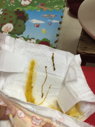 为您推荐: 其他回答 蛔虫一样的,恐怖啊 匿名用户    2015-01-13 20